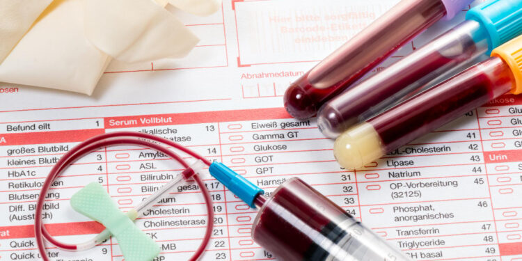 미국에서 채혈사(Phlebotomist)로 일하려면? 자격 취득부터 연봉, 취업 전망까지